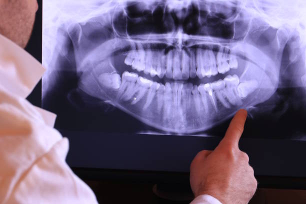 Best Emergency Treatment for Dental Infections or Abscesses in Randolph, NE
