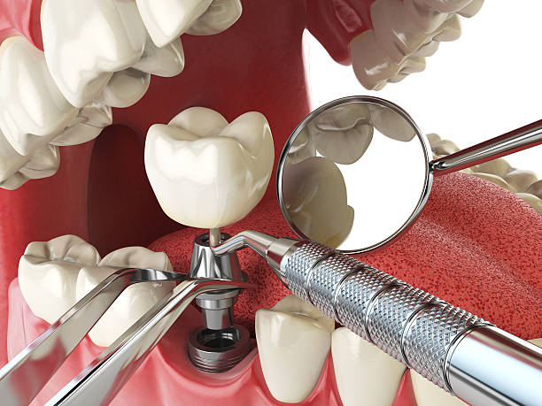 Best Cosmetic Emergency Dentistry in Randolph, NE