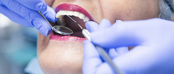 Best Emergency Tooth Extraction in Randolph, NE